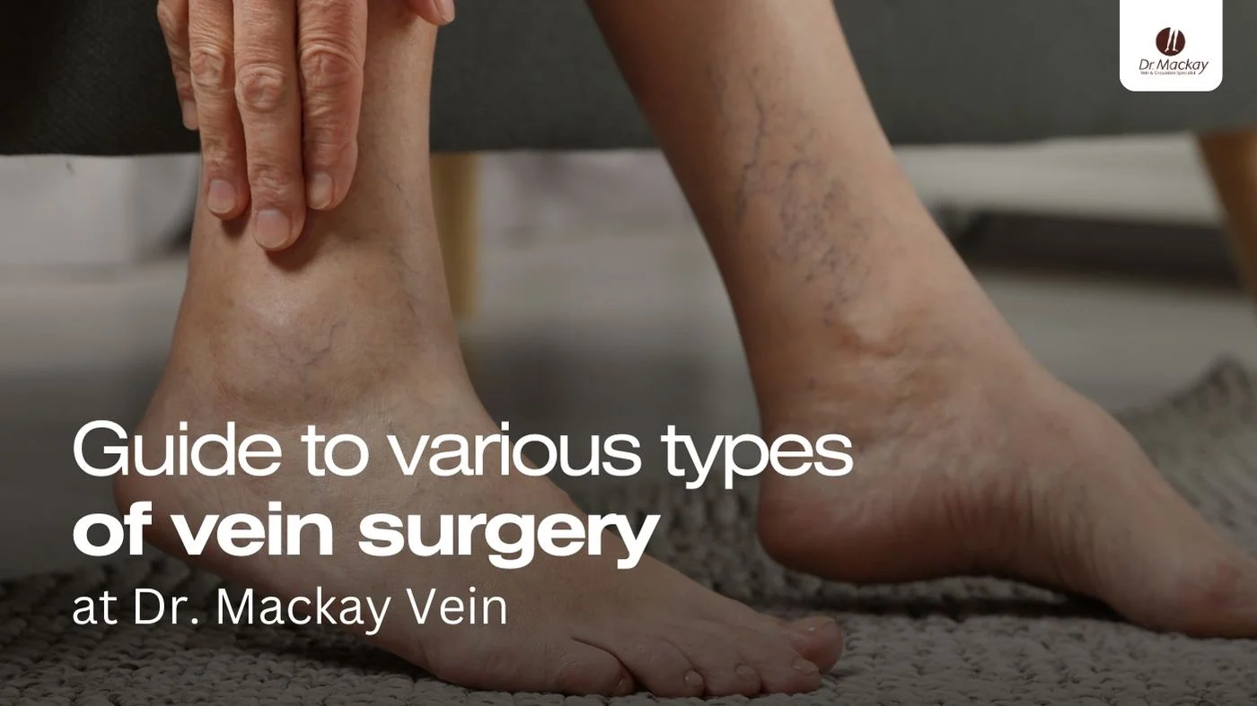 Vein surgery guide blog banner
