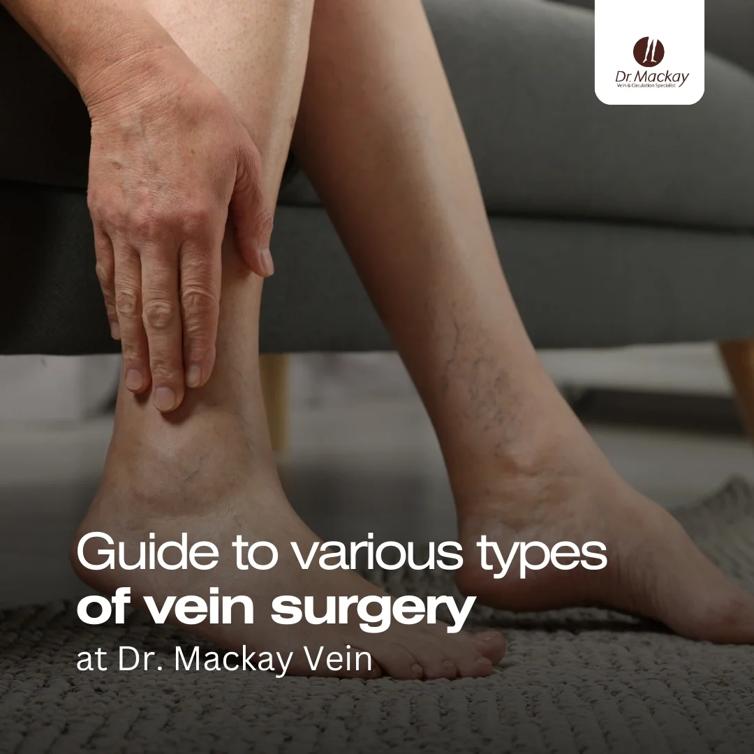MAC - Vein surgery guide - IG