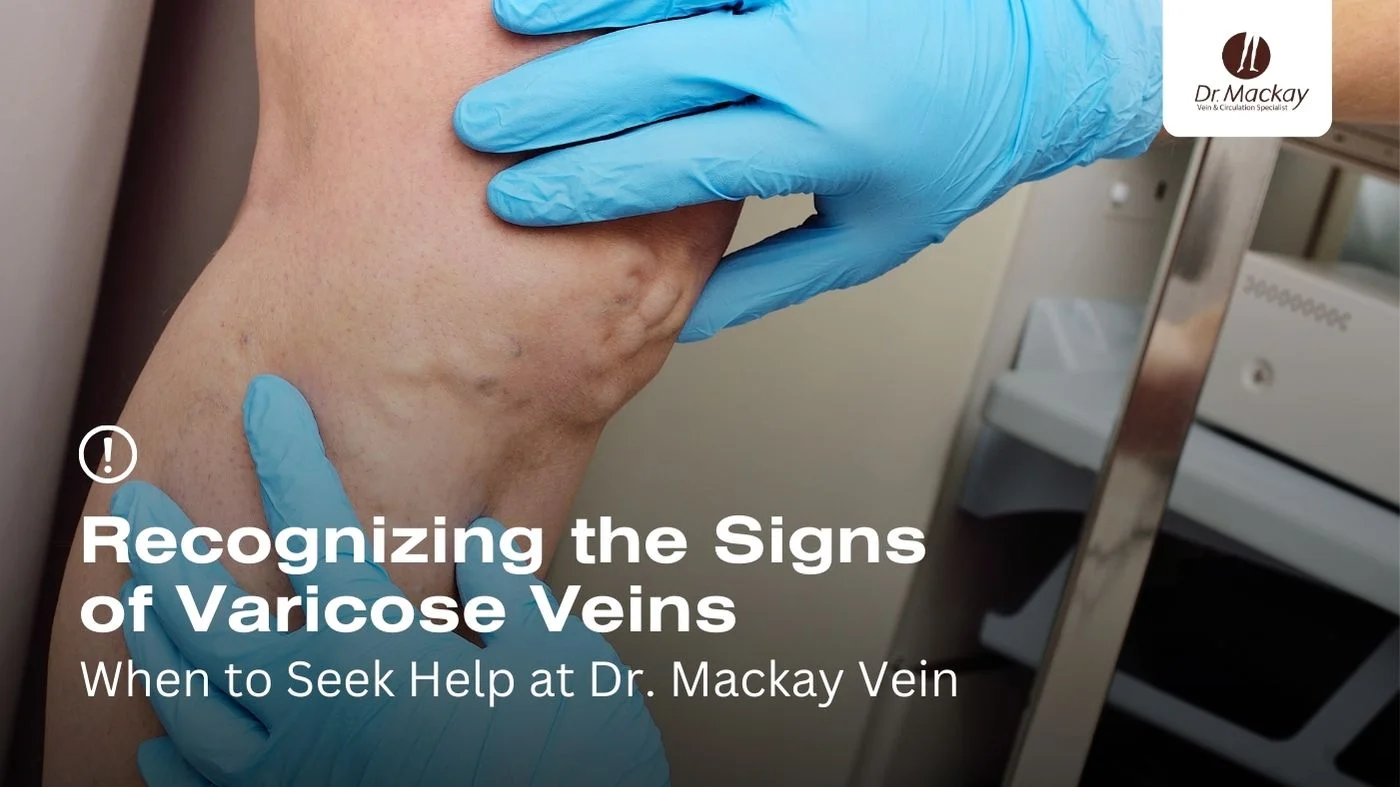 when to worry about varicose veins blog banner dr mackay tampa pinellas
