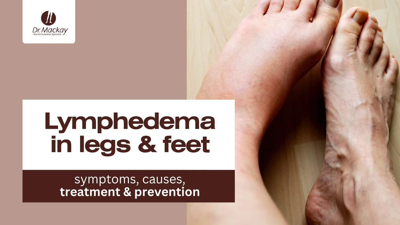 What Causes Lymphedema in the Legs & Feet
