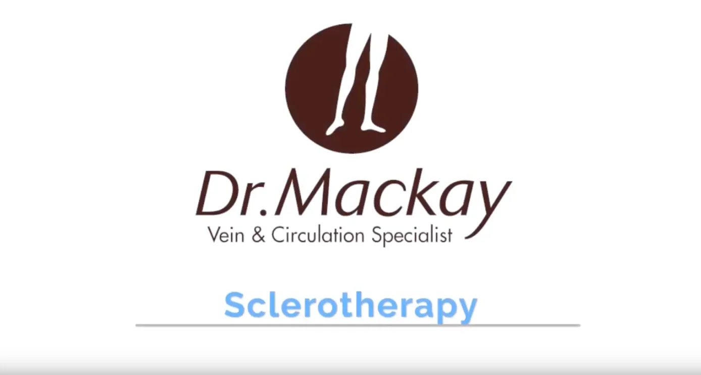 sclerotherapy video cover mackay tampa