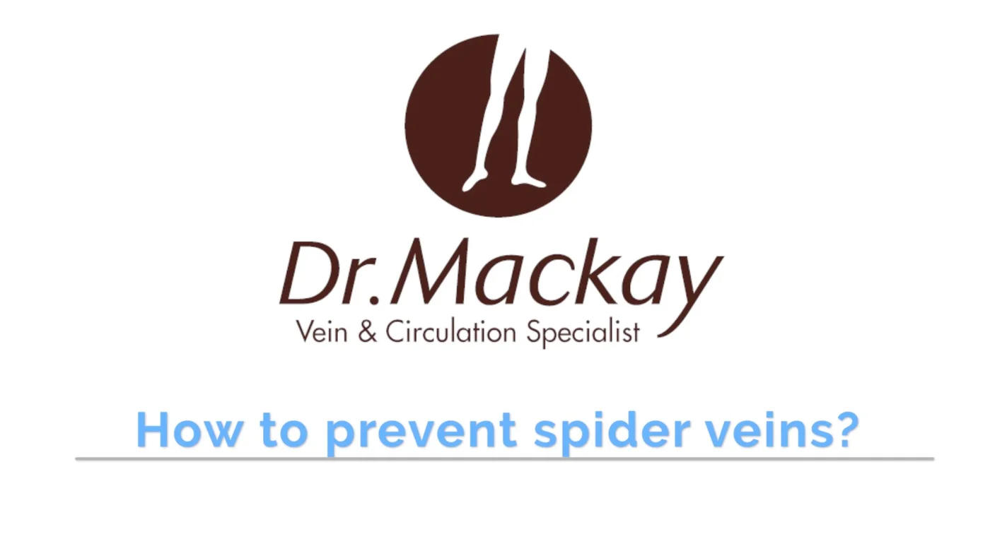 Spider Veins Prevention