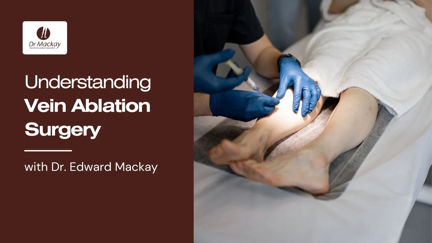 Vein Ablation surgery guide with dr edward mackay - Blog