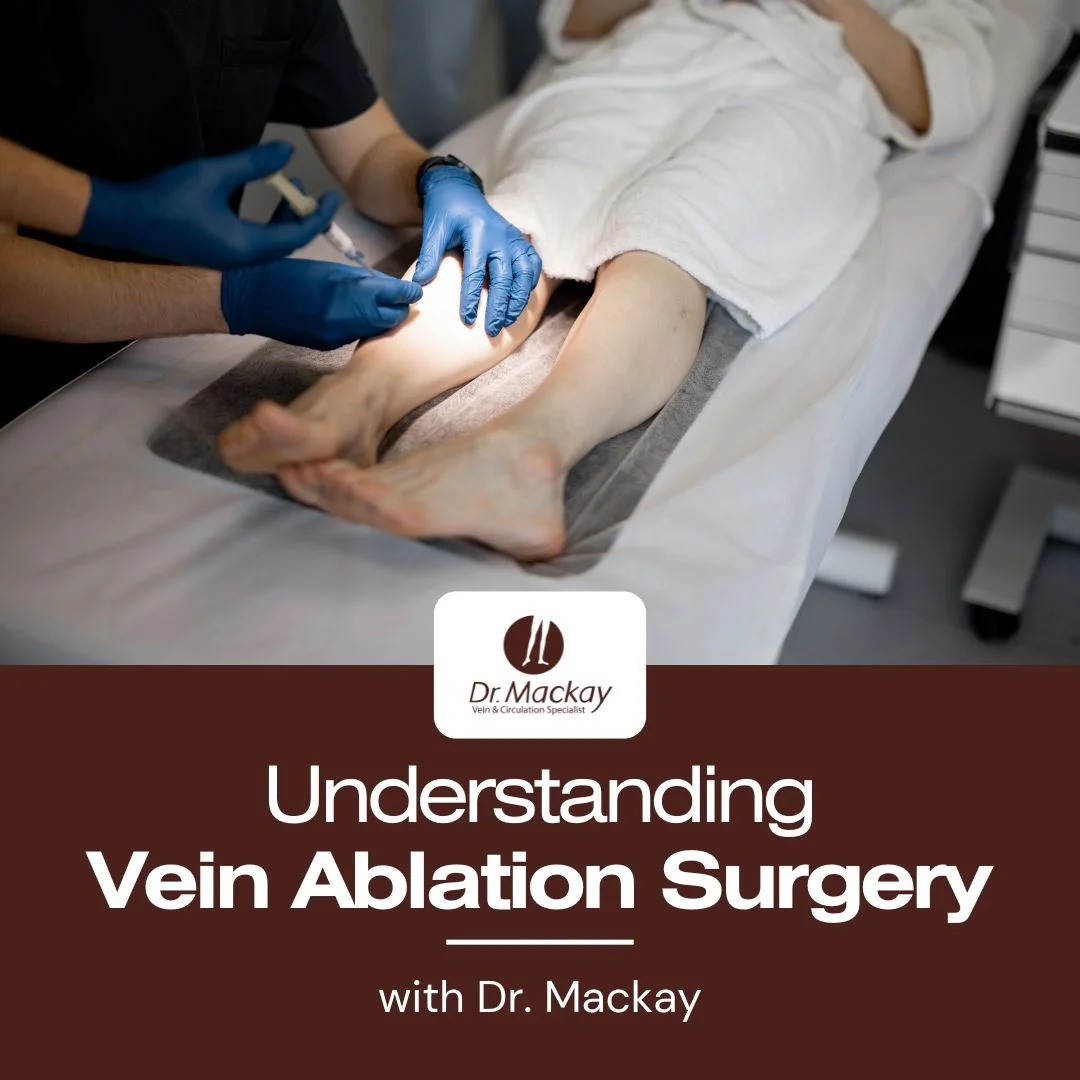 Vein Ablation surgery guide with dr edward mackay - IG